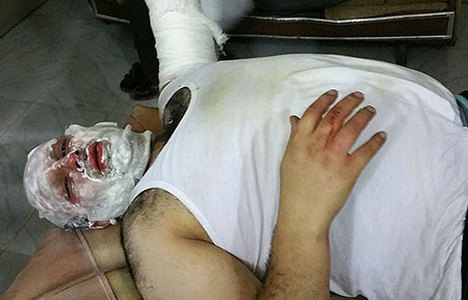 AA muhabiri Halep'te yaralandı